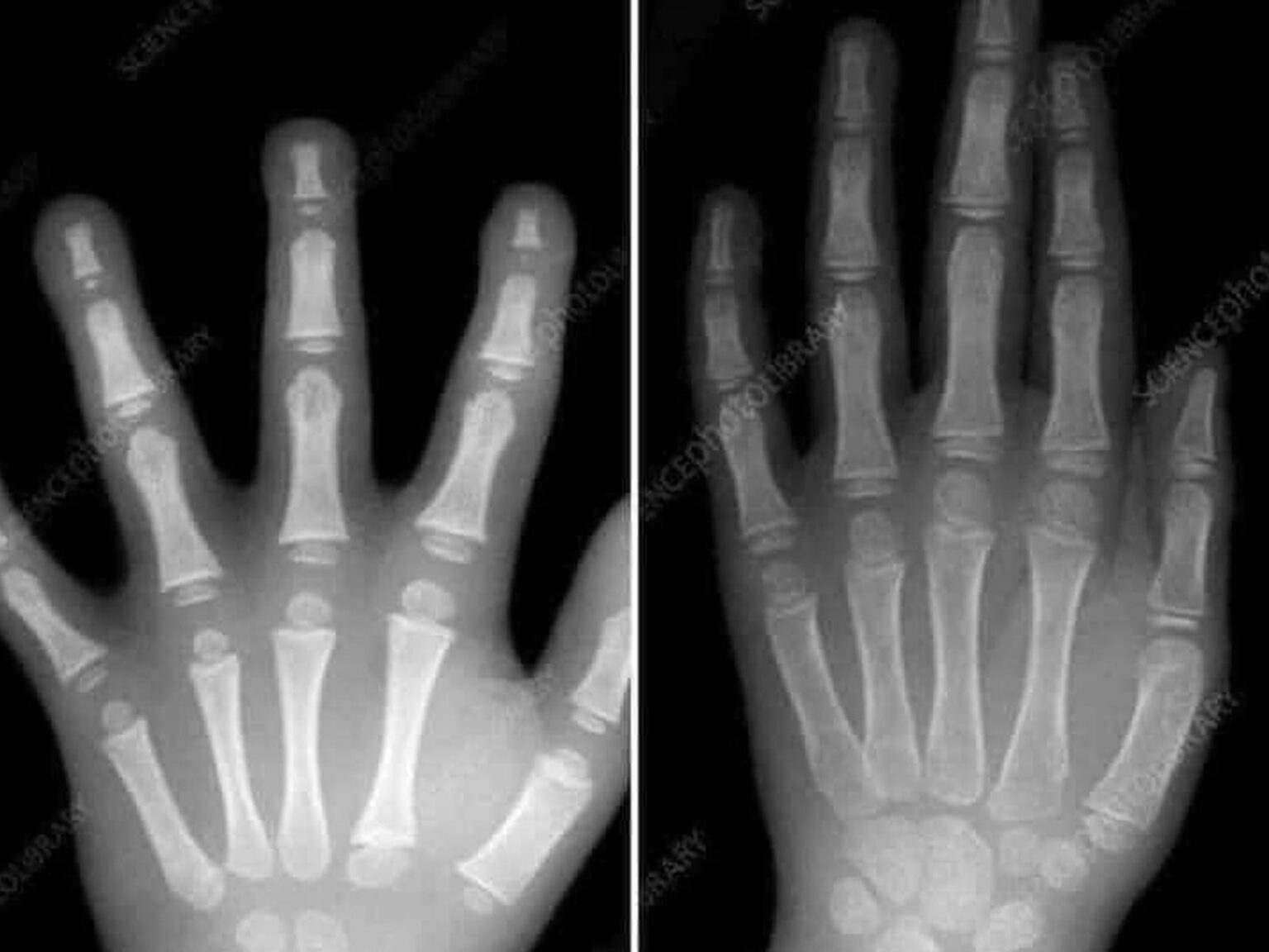 Μην πιέζετε τα παιδιά προσχολικής ηλικίας να γράφουν: Υπάρχει σοβαρός λόγος που οι περισσότεροι αγνοούμε