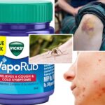 Vicks VapoRub: 10 ασυνήθιστες χρήσεις