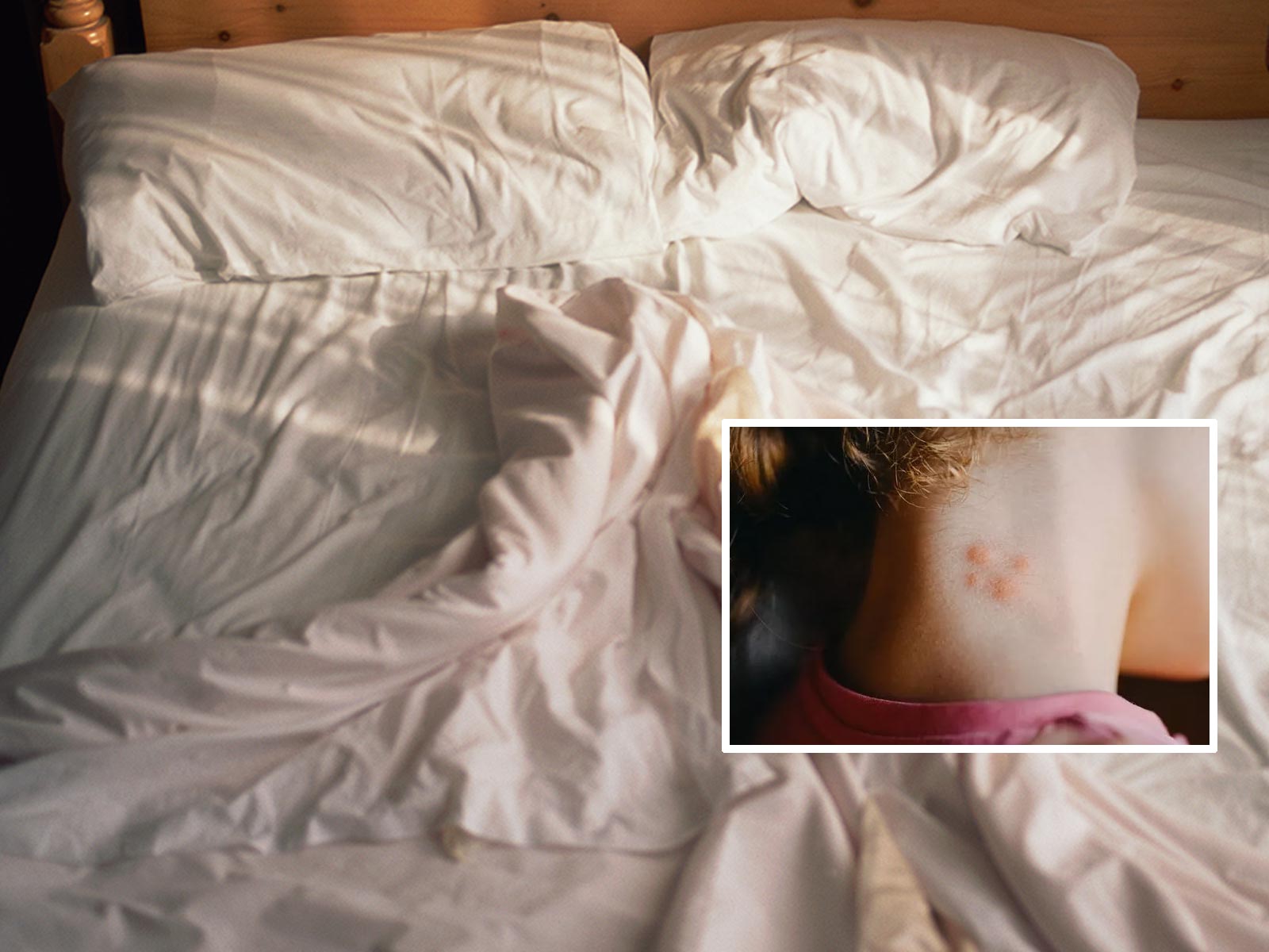 Πώς θα καταλάβετε αν έχετε ακάρεα σκόνης στο κρεβάτι σας