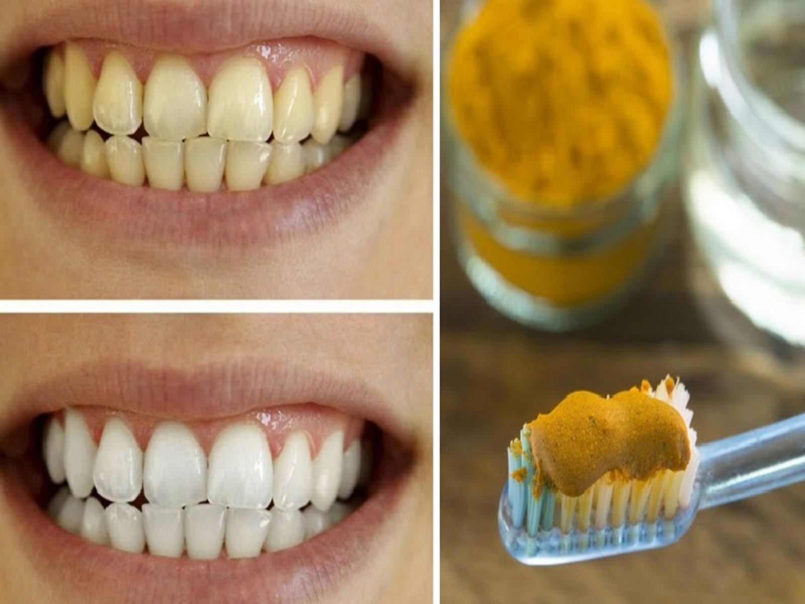 Ανακαλύψτε τη Φυσική Δύναμη του Κουρκουμά στην Υγεία των Δοντιών