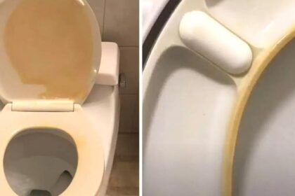 Κιτρινισμένο καπάκι τουαλέτας που δεν καθαρίζει με τίποτα: Υπάρχει τρόπος να λύσεις το πρόβλημα