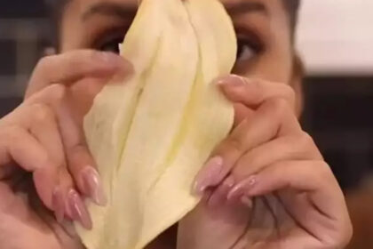 Banana Botox; Οι ειδικοι προειδοποιούν την Gen Z ότι αυτό το κόλπο ομορφιάς μπορεί να βλάψει