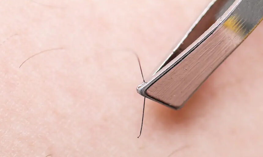 Τρίχες που γυρίζουν προς τα μέσα: Τι κάνεις σε 5 βήματα