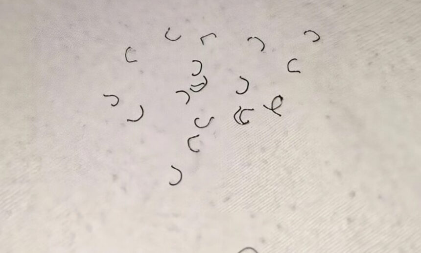 Τι είναι αυτά τα νήματα που μπορεί να βρίσκετε διάσπαρτα μέσα στο σπίτι στο κρεβάτι ή και πάνω σας