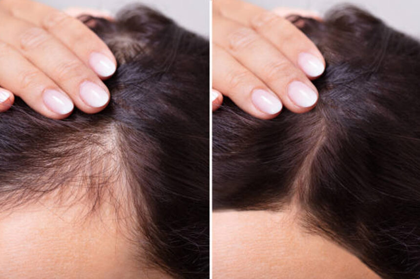 Μου πέφτουν τα μαλλιά: 7 βασικές αιτίες