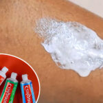 Αλήθεια ή ψέμα; Μπορεί η Colgate να αφαιρέσει μόνιμα την ανεπιθύμητη τριχοφυΐα;