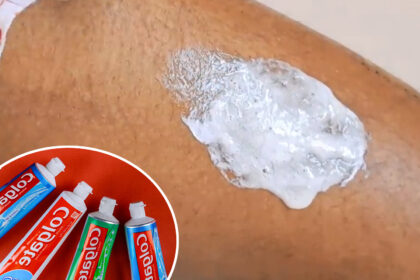 Αλήθεια ή ψέμα; Μπορεί η Colgate να αφαιρέσει μόνιμα την ανεπιθύμητη τριχοφυΐα;