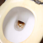 Μια γυναίκα αναζήτησε συμβουλές για να αφαιρέσει το πουρί από τη λεκάνη της τουαλέτας και οι λάτρεις της καθαριότητας κατέληξαν σε ένα μόνο υλικό που κάνει δουλειά αποτελεσματική.