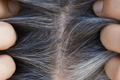 Γυρίζουν Πίσω τα Γκρίζα Μαλλιά; Οι Επιστήμονες Έχουν Άλλη Άποψη