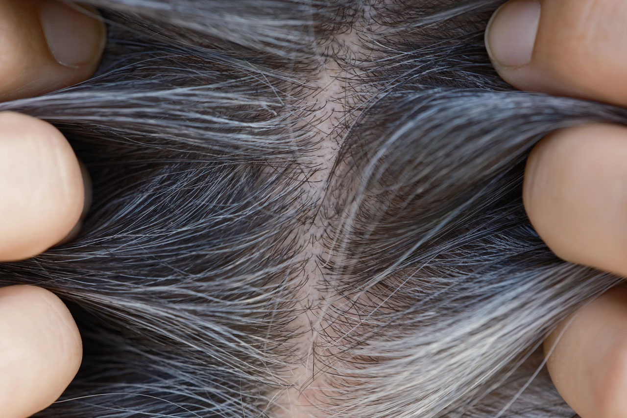 Γυρίζουν Πίσω τα Γκρίζα Μαλλιά; Οι Επιστήμονες Έχουν Άλλη Άποψη