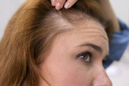 Το Μυστικό συστατικό της Κουζίνας που Σταματά την Τριχόπτωση και κάνει Πυκνά τα Μαλλιά