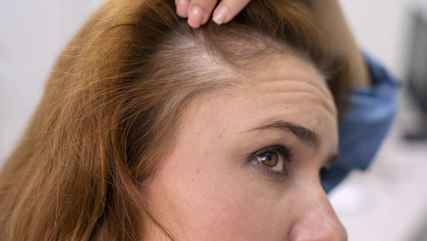 Το Μυστικό συστατικό της Κουζίνας που Σταματά την Τριχόπτωση και κάνει Πυκνά τα Μαλλιά