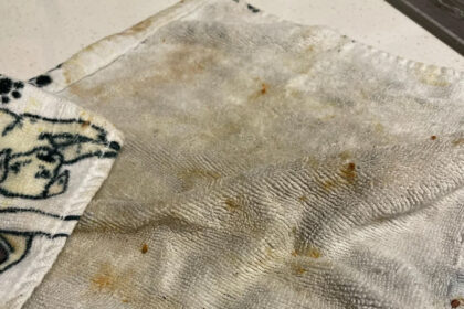 Πώς να αφαιρέσετε ποτισμένους λεκέδες σε πετσέτες κουζίνας χωρίς πλύσιμο: υπάρχει αυτή η μέθοδος