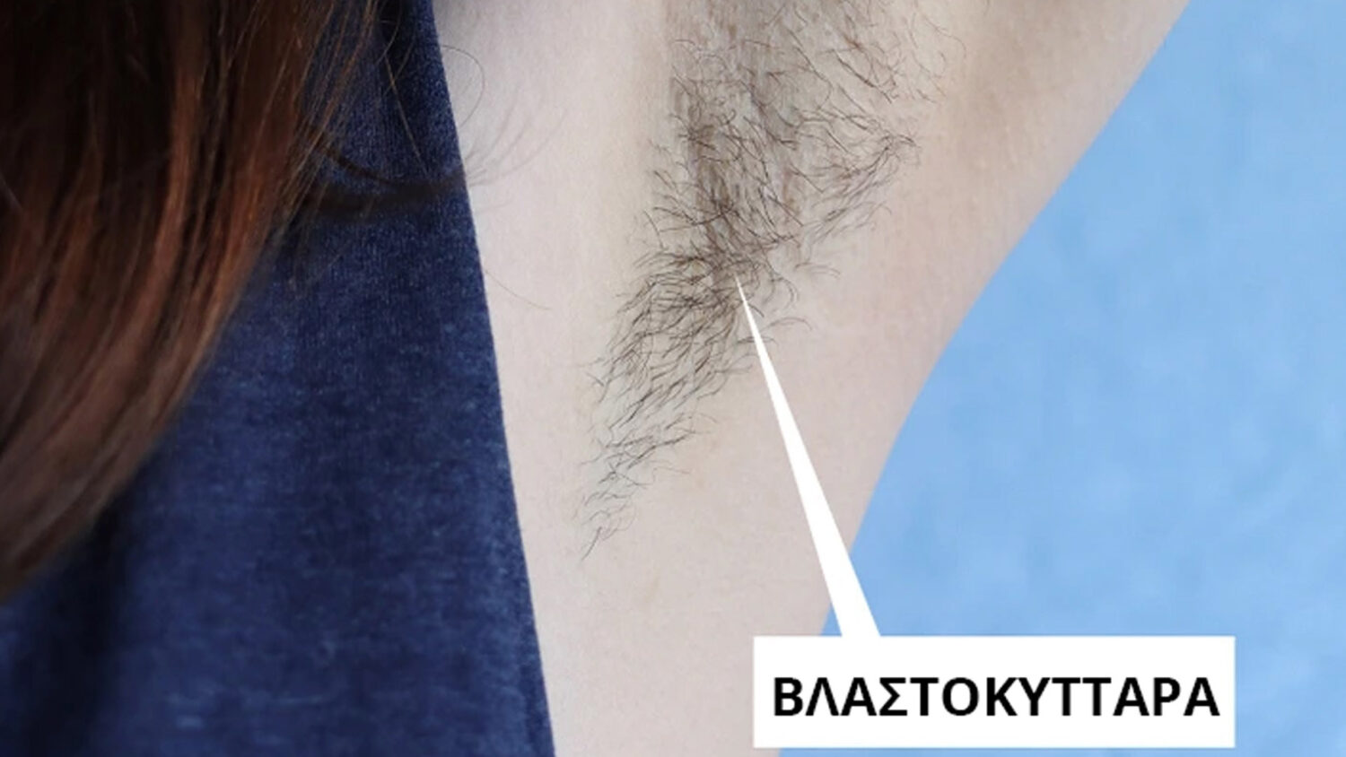 Τι θα συμβεί στο σώμα σας αν σταματήσετε να ξυρίζετε τις τρίχες σας