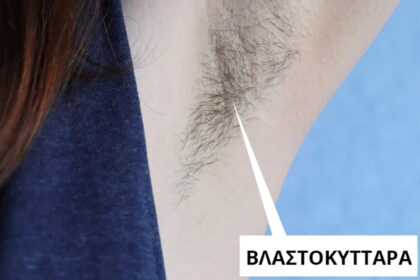 Τι θα συμβεί στο σώμα σας αν σταματήσετε τα ξυρίζετε τις τρίχες σας