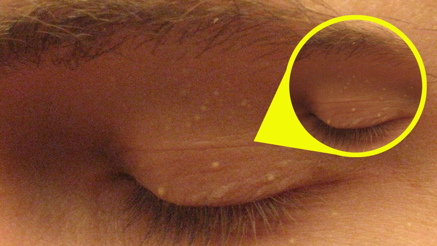 Υπόθεση Πρόσωπο: 4 σημάδια για να αναγνωρίζεις αποτελεσματικά τι συμβαίνει