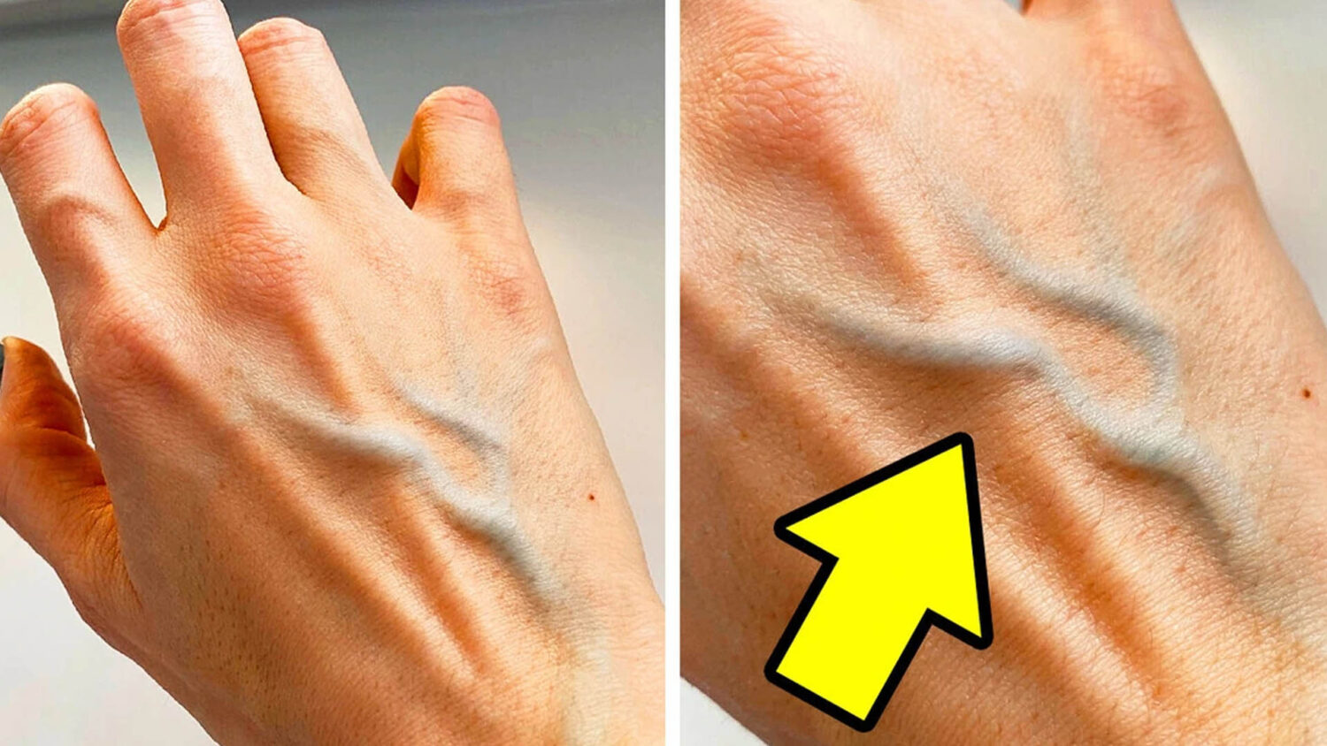 Δεν έχεις μόνο 5 αισθήσεις: Απίστευτα facts για το σώμα που λίγοι γνωρίζουν