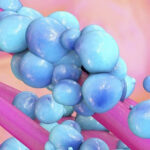 Ένα βακτήριο του εντέρου συνδέεται με τον καρκίνο του παχέος εντέρου - δείτε πώς να μείνετε υγιείς