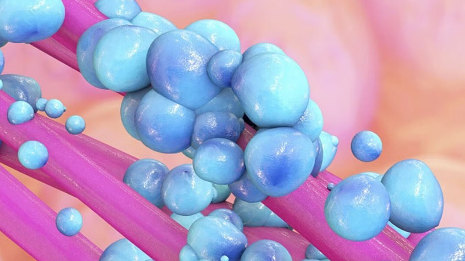 Ένα βακτήριο του εντέρου συνδέεται με τον καρκίνο του παχέος εντέρου - δείτε πώς να μείνετε υγιείς