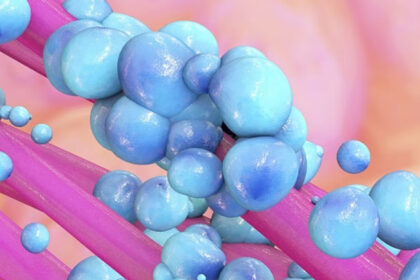 Ένα βακτήριο του εντέρου συνδέεται με τον καρκίνο του παχέος εντέρου - δείτε πώς να μείνετε υγιείς