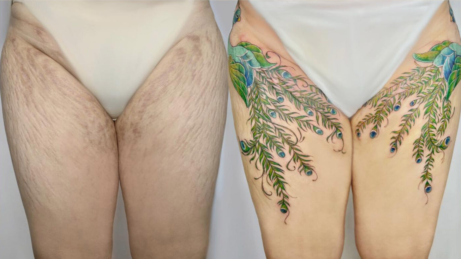 15 άνθρωποι που μετέτρεψαν τις ουλές τους σε υπέροχα τατουάζ χάρις σε μια Tattoo Artist από το Βιετνάμ