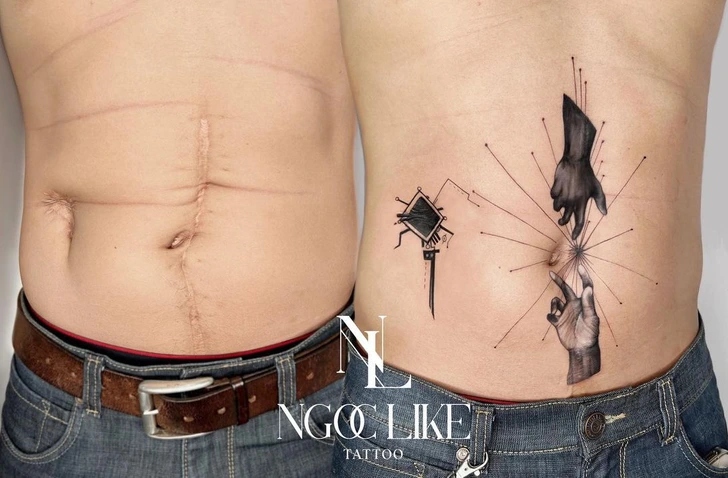 15 άνθρωποι που μετέτρεψαν τις ουλές τους σε υπέροχα τατουάζ χάρις σε μια Tattoo Artist από το Βιετνάμ 12 15 άνθρωποι που μετέτρεψαν τις ουλές τους σε υπέροχα τατουάζ χάρις σε μια Tattoo Artist από το Βιετνάμ