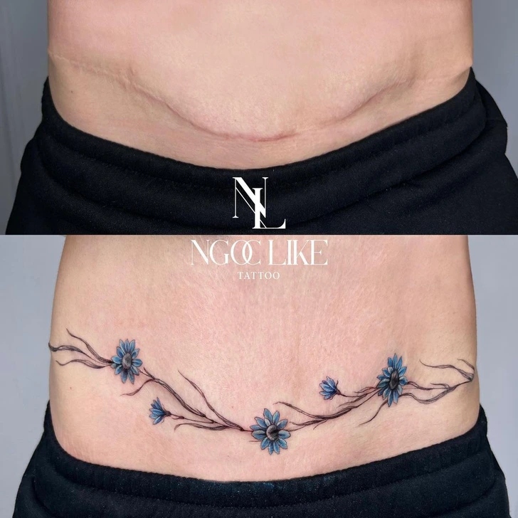 15 άνθρωποι που μετέτρεψαν τις ουλές τους σε υπέροχα τατουάζ χάρις σε μια Tattoo Artist από το Βιετνάμ 13 15 άνθρωποι που μετέτρεψαν τις ουλές τους σε υπέροχα τατουάζ χάρις σε μια Tattoo Artist από το Βιετνάμ