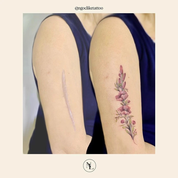 15 άνθρωποι που μετέτρεψαν τις ουλές τους σε υπέροχα τατουάζ χάρις σε μια Tattoo Artist από το Βιετνάμ 16 15 άνθρωποι που μετέτρεψαν τις ουλές τους σε υπέροχα τατουάζ χάρις σε μια Tattoo Artist από το Βιετνάμ