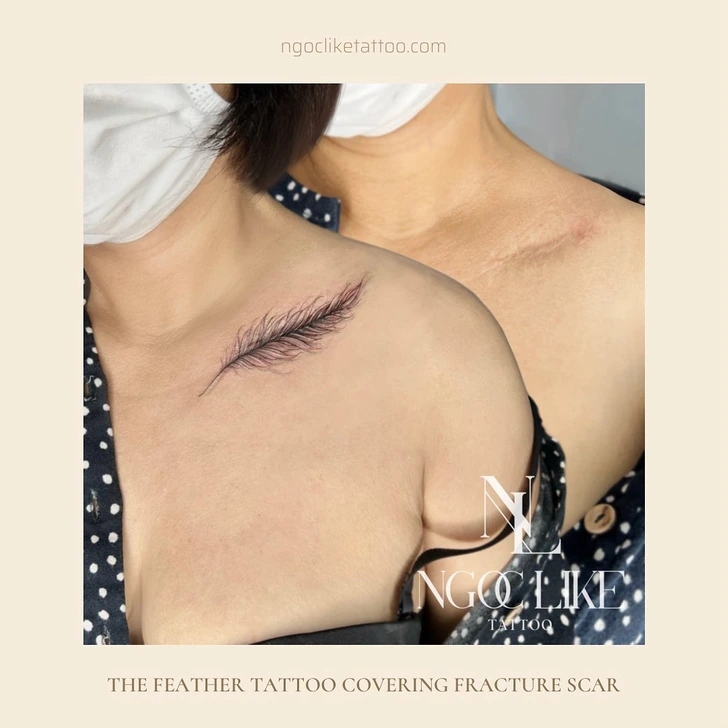 15 άνθρωποι που μετέτρεψαν τις ουλές τους σε υπέροχα τατουάζ χάρις σε μια Tattoo Artist από το Βιετνάμ 4 15 άνθρωποι που μετέτρεψαν τις ουλές τους σε υπέροχα τατουάζ χάρις σε μια Tattoo Artist από το Βιετνάμ