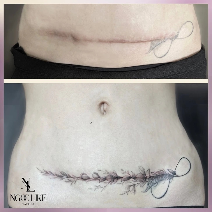 15 άνθρωποι που μετέτρεψαν τις ουλές τους σε υπέροχα τατουάζ χάρις σε μια Tattoo Artist από το Βιετνάμ 6 15 άνθρωποι που μετέτρεψαν τις ουλές τους σε υπέροχα τατουάζ χάρις σε μια Tattoo Artist από το Βιετνάμ