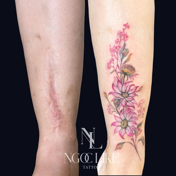 15 άνθρωποι που μετέτρεψαν τις ουλές τους σε υπέροχα τατουάζ χάρις σε μια Tattoo Artist από το Βιετνάμ 7 15 άνθρωποι που μετέτρεψαν τις ουλές τους σε υπέροχα τατουάζ χάρις σε μια Tattoo Artist από το Βιετνάμ