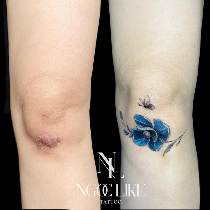 15 άνθρωποι που μετέτρεψαν τις ουλές τους σε υπέροχα τατουάζ χάρις σε μια Tattoo Artist από το Βιετνάμ 10 15 άνθρωποι που μετέτρεψαν τις ουλές τους σε υπέροχα τατουάζ χάρις σε μια Tattoo Artist από το Βιετνάμ