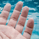 Γιατί ζαρώνουν τα δάχτυλα στο νερό: Τι προσπαθεί να κάνει το σώμα σου