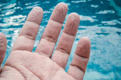 Γιατί ζαρώνουν τα δάχτυλα στο νερό: Τι προσπαθεί να κάνει το σώμα σου