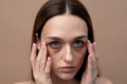 Έχεις σακούλες κάτω από τα μάτια; Δες τι μπορεί να τις κάνει χειρότερες