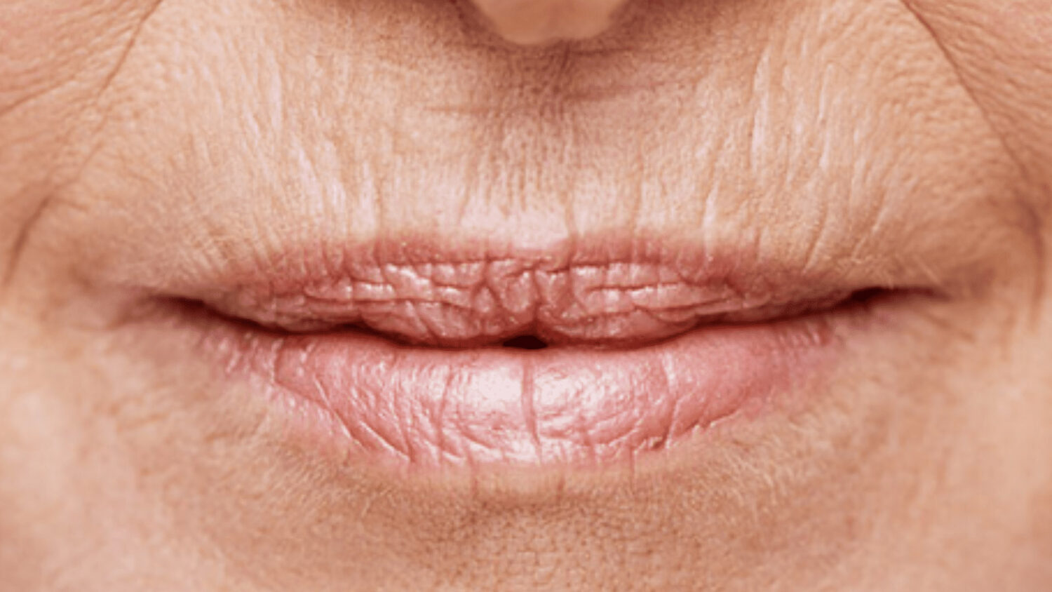 Ρυτίδες γύρω από το στόμα: Εμφανίζονται πιο γρήγορα από όσο νομίζεις - Πώς να τις αντιμετωπίσεις
